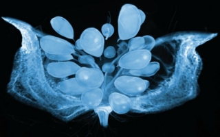 CT-Picture-of-a-Cotton-Boll.jpg